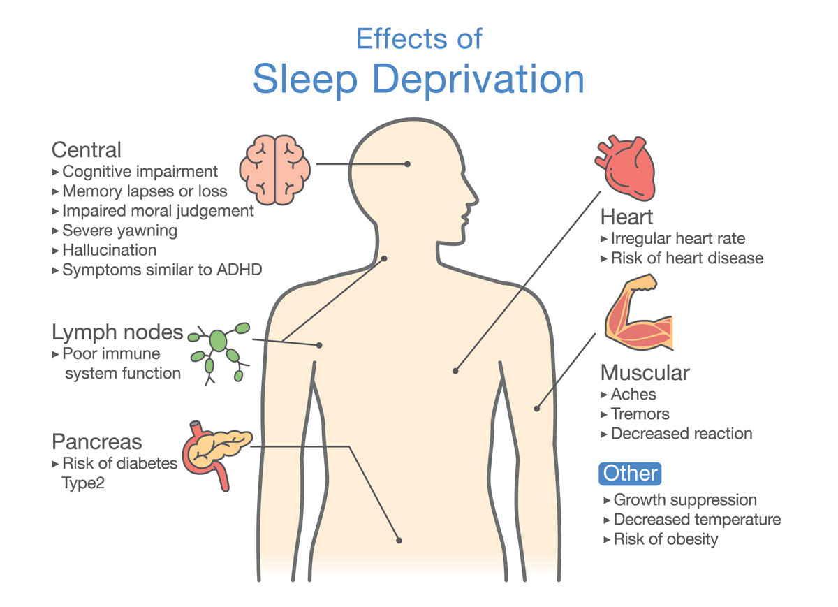 What is Sleep Deprivation?